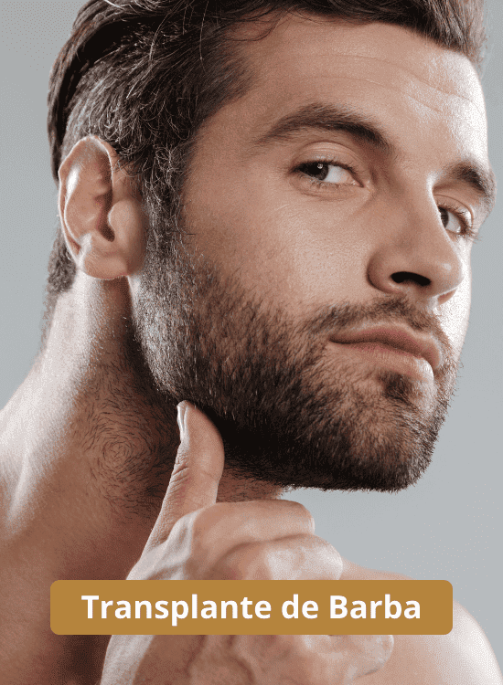 Transplante de barba em montes claros